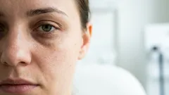 Como eliminar as olheiras sem cremes caros - 7 regras simples de um especialista